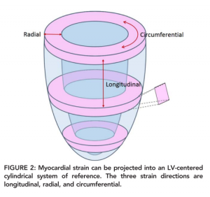 3種類のストレイン：longitudinal, radial, circumferential　　 文献[10]より引用